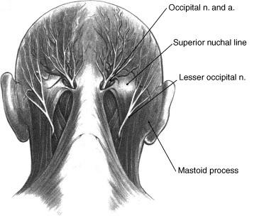 Occipital Neuralgia